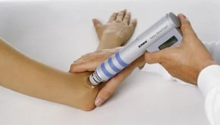 Лечение за тенис лакът