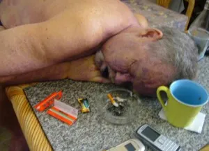 Какво да правите, ако свръхдоза