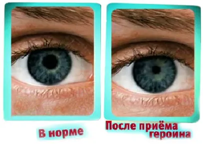 Какво да правите, ако свръхдоза