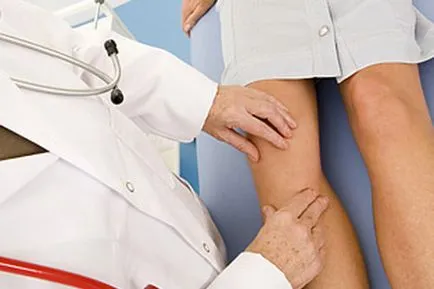 лечение polyosteoarthrosis