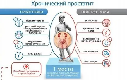 Простатит симптоми при мъжете Простатит симптоми при мъжете