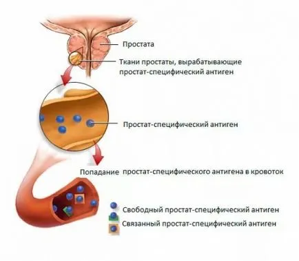 Простатит симптоми при мъжете Простатит симптоми при мъжете