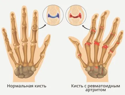 хормоните пептиди