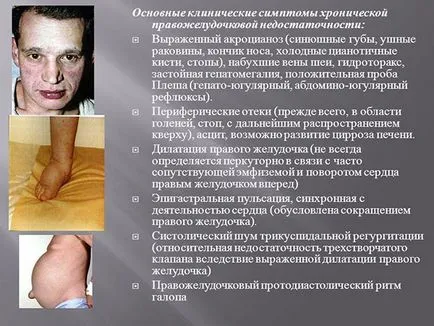 степен на сърдечна недостатъчност