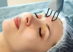 Нехирургичен окото