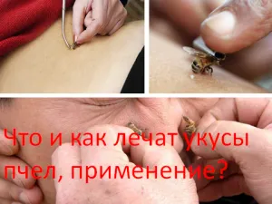 Какво и как да се отнасяме пчелни ужилвания, използвам моя шаман