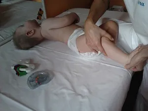 Какво е това синдром Веста причините на заболяването, симптомите и признаците, лечението на заболяването