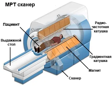 Какъв по-добър CT или различия на мозъка изображения ядрено-магнитен резонанс (по-добър) Какъв по-добър CT или различия на мозъка изображения ядрено-магнитен резонанс