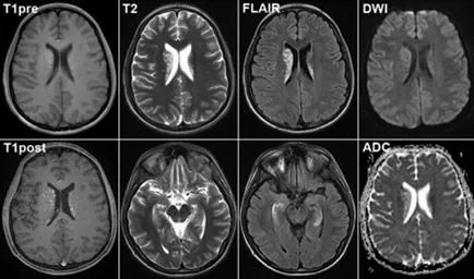 Какъв по-добър CT или MRI на мозъка и как те се различават