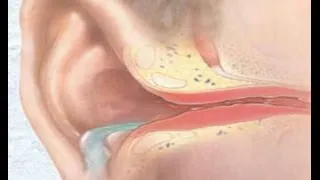 Двустранни отит Симптоми и лечение при възрастни