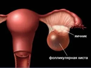 Фоликули в яйчниците, че е