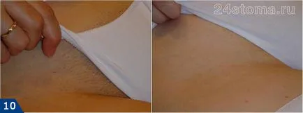 Фотоепилация - ревюта, противопоказания и ефекти цени