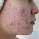 Как и защо пъпки пъпки форма