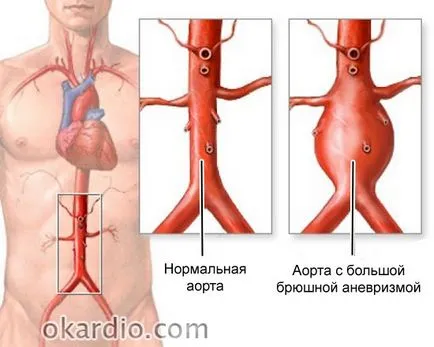 Как да се провери на кръвоносните съдове на цяло тяло ултразвук и ангиография, когато трябва да се направи