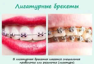 Скоби лигатура и bezligaturnye