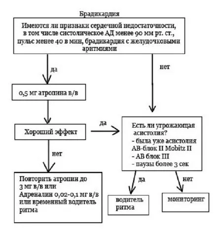 Брадикардия - причини, симптоми, симптоми и лечение (сърдечен ритъм) Брадикардия - причини, симптоми, симптоми и лечение