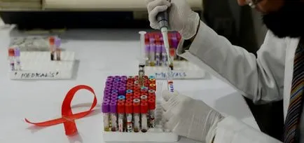 Как да убива всички показатели HIV-температурни неблагоприятно влияние върху ретровирус (която) Как да убива всички показатели HIV-температурни неблагоприятно влияние върху ретровирус