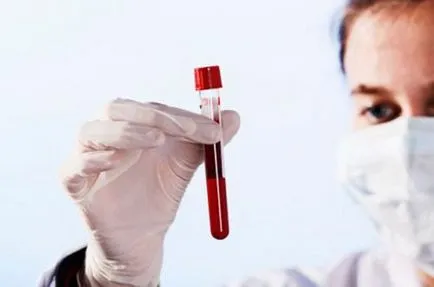 Как да убива всички показатели HIV-температурни неблагоприятно влияние върху ретровирус (която) Как да убива всички показатели HIV-температурни неблагоприятно влияние върху ретровирус