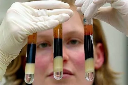 Как да убива всички показатели HIV-температурни се отрази неблагоприятно на ретровирус (температура) Как да убива всички показатели HIV-температурни неблагоприятно влияние върху ретровирус