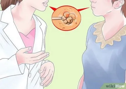 Как да забременея с PCOS