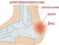 Какво сърби лявата пета към момичето, мъжете подписват, интерпретация