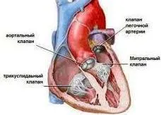 Сърдечни клапи - изкуствени сърдечни клапи