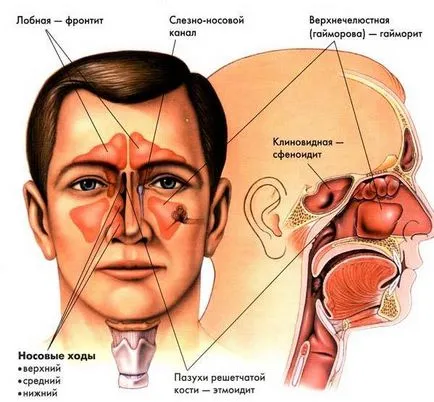 Компютърна томография (КТ) на параназалните синуси - това показва,