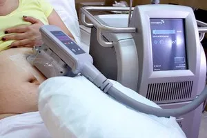 Cryolipolysis как работи този метод, използването на тази процедура в салона и у дома,