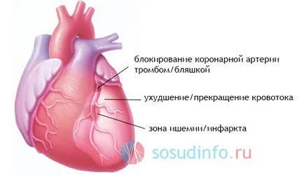 Незначителни сърдечни симптоми и признаци на лечение