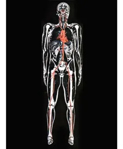 MRI на цялото тяло, колко е пълна проверка MRI, възможно ли е да се направи MR изображения веднага
