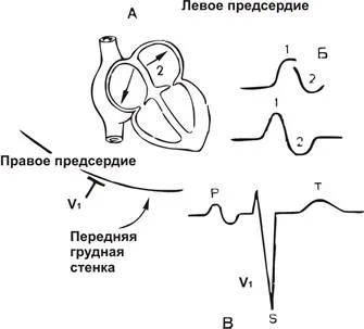 Нормално ЕКГ - studopediya