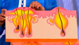 Имаше буца под ръката ми и ме боли