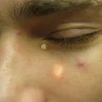 Ами ако е имало Уен по лицето