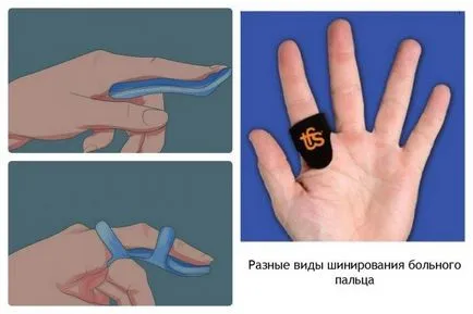 Какво да правите, когато пръстите си, кликнете върху видео лечение и превенция на упражненията за пръстите на