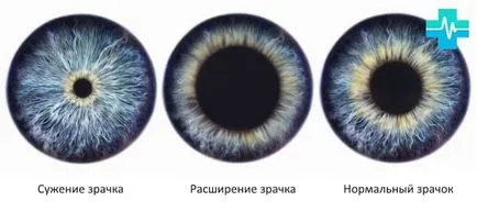 разширени зеници