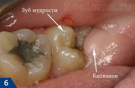 Отглеждане мъдрец - какво да правя, бърза помощ