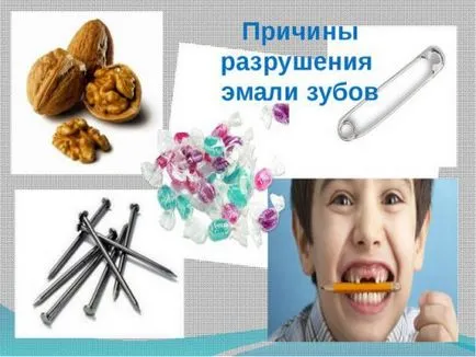 Унищожаването на емайла на зъбите причинява симптоми, външни фактори, заболявания