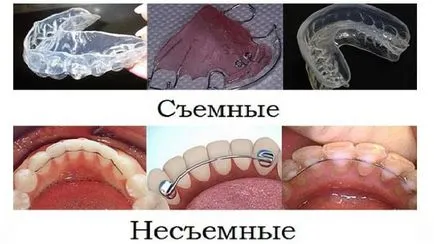 Кука след скобите, които му придават и колко трябва да се носят