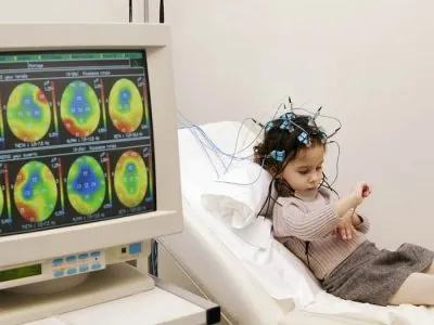синдром на Уест какво е, признаците на дали е възможно възстановяване