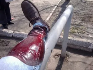 Ухапан от куче какво да се прави на първа помощ
