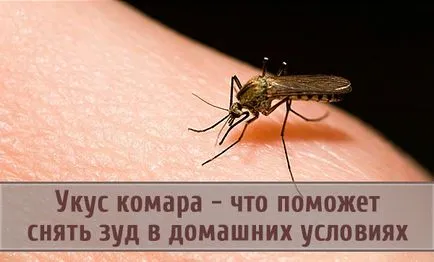Mosquito хапка - което ще помогне за облекчаване на сърбеж у дома, хората sredstvathis е например заглавие на (премахнете) Mosquito хапка - което ще помогне за облекчаване на сърбеж у дома, хората sredstvathis е например заглавие на