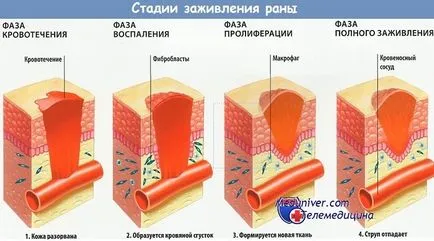 Възстановяване на епитела рана