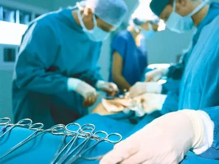 Működés a tüdőben a tuberkulózis, a tüdő sebészi eltávolítása, thoracoplasty