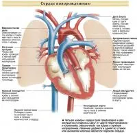 Дефекти сърцето при новородени (заболявания - кардиология)