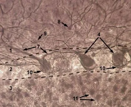 Cerebelul câine de droguri №8