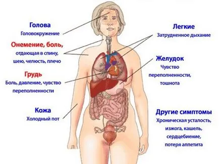 Semne si simptome de infarct miocardic la bărbați și femei