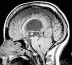 Copiii filiala Psychoneurological la Moscova