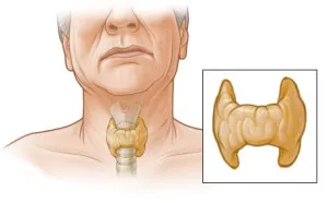 Пробиването на щитовидната жлеза, как се правят нещата, и последиците от