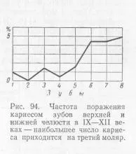 Разпространението на кариес превантивна стоматология