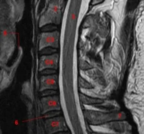 Face un RMN al coloanei cervicale prețurilor gâtului și a coloanei vertebrale mri în St. Petersburg